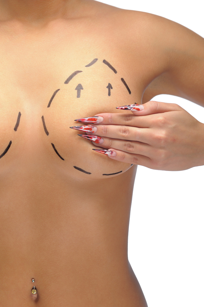 Breast Augmentation Melbourne Plastic Surgery